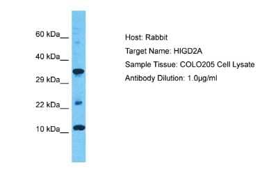 Western Blot: HIGD2A Antibody [NBP2-83045] - Host: Rabbit. Target Name: HIGD2A. Sample Type: COLO205 Whole Cell lysates. Antibody Dilution: 1.0ug/ml