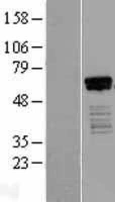 Western Blot: HINFP Overexpression Lysate (Adult Normal) [NBL1-13119] Left-Empty vector transfected control cell lysate (HEK293 cell lysate); Right -Over-expression Lysate for HINFP.