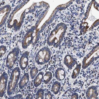 Immunohistochemistry-Paraffin: HINT2 Antibody [NBP1-86024] - Staining of human duodenum shows strong granular cytoplasmic positivity in glandular cells.