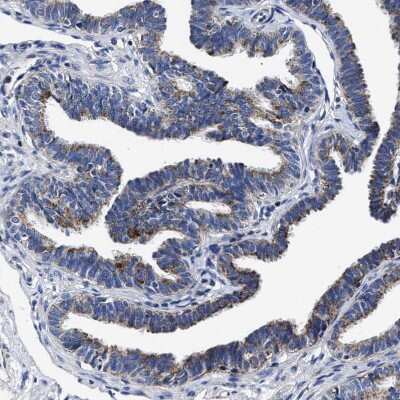 Immunohistochemistry-Paraffin: HINT2 Antibody [NBP1-86024] - Staining of human fallopian tube shows moderate granular cytoplasmic positivity in glandular cells.