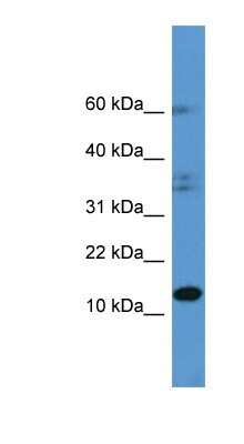 Western Blot: HINT2 Antibody [NBP1-79802] - Human Brain lysate, concentration 0.2-1 ug/ml.