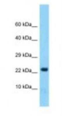 Western Blot: HINT2 Antibody [NBP1-98460] - Mouse Brain Lysate 1.0ug/ml, Gel Concentration: 10-20%