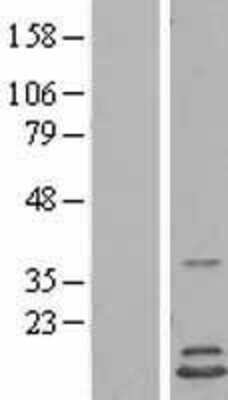 Western Blot: HINT2 Overexpression Lysate (Adult Normal) [NBL1-11546] Left-Empty vector transfected control cell lysate (HEK293 cell lysate); Right -Over-expression Lysate for HINT2.