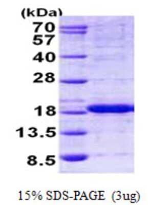 SDS-Page: HINT2 Protein [NBP2-23124]