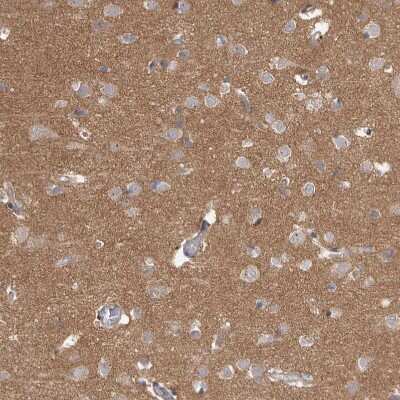 Immunohistochemistry-Paraffin HINT3 Antibody - BSA Free