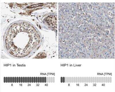 <b>Orthogonal Strategies Validation. </b>Immunohistochemistry-Paraffin: HIP1 Antibody [NBP1-81592] - Analysis in human testis and liver tissues using Anti-HIP1 antibody. Corresponding HIP1 RNA-seq data are presented for the same tissues.