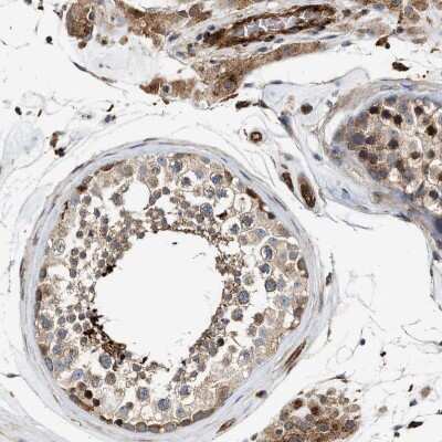 Immunohistochemistry-Paraffin: HIP1 Antibody [NBP1-81592] - Staining of human testis shows high expression.