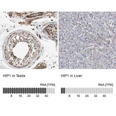 <b>Orthogonal Strategies Validation. </b>Immunohistochemistry-Paraffin: HIP1 Antibody [NBP1-81592] - Staining in human testis and liver tissues using anti-HIP1 antibody. Corresponding HIP1 RNA-seq data are presented for the same tissues.