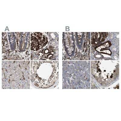 <b>Independent Antibodies Validation. </b>Immunohistochemistry-Paraffin: HIP1 Antibody [NBP1-81592] - Staining of human colon, kidney, liver and testis using Anti-HIP1 antibody NBP1-81592 (A) shows similar protein distribution across tissues to independent antibody NBP1-81593 (B).