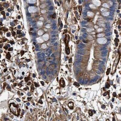 Immunohistochemistry-Paraffin: HIP1 Antibody [NBP1-81592] - Staining of human colon.