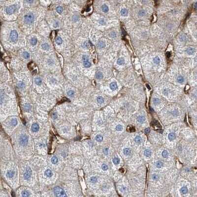 Immunohistochemistry-Paraffin: HIP1 Antibody [NBP1-81592] - Staining of human liver using Anti-HIP1 antibody NBP1-81592.