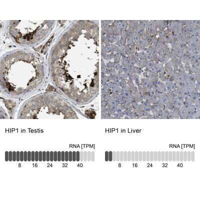 <b>Orthogonal Strategies Validation. </b>Immunohistochemistry-Paraffin: HIP1 Antibody [NBP1-81593] - Staining in human testis and liver tissues using anti-HIP1 antibody. Corresponding HIP1 RNA-seq data are presented for the same tissues.