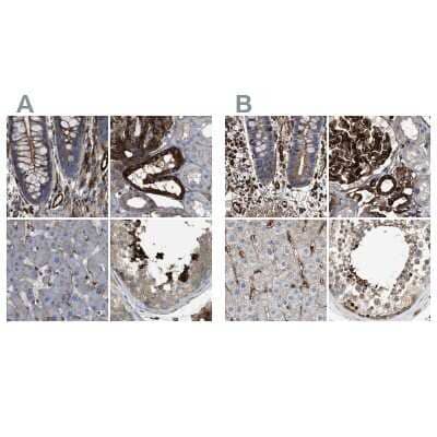 <b>Independent Antibodies Validation. </b>Immunohistochemistry-Paraffin: HIP1 Antibody [NBP1-81593] - Staining of human colon, kidney, liver and testis using Anti-HIP1 antibody NBP1-81593 (A) shows similar protein distribution across tissues to independent antibody NBP1-81592 (B).