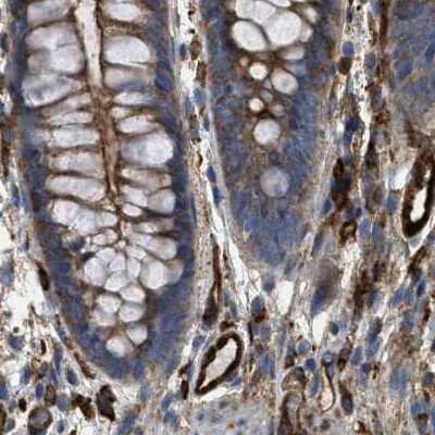 Immunohistochemistry-Paraffin: HIP1 Antibody [NBP1-81593] - Staining of human colon.