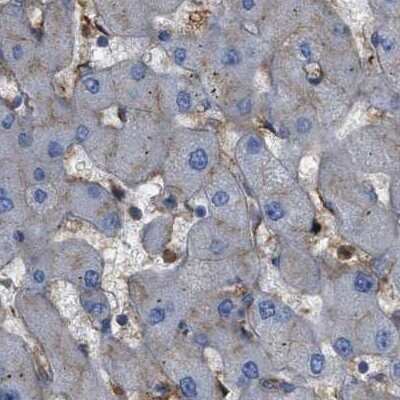 Immunohistochemistry-Paraffin: HIP1 Antibody [NBP1-81593] - Staining of human liver using Anti-HIP1 antibody NBP1-81593.