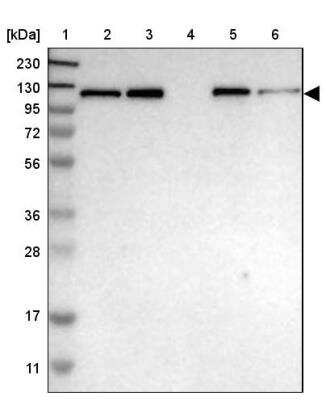 Western Blot: HIP1 Antibody [NBP1-81593] - Lane 1: Marker  [kDa] 230, 130, 95, 72, 56, 36, 28, 17, 11.  Lane 2: Human cell line RT-4.  Lane 3: Human cell line U-251MG sp.  Lane 4: Human plasma (IgG/HSA depleted).  Lane 5: Human liver tissue.  Lane 6: Human tonsil tissue