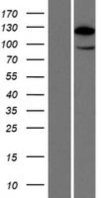 Western Blot: HIP1 Related Overexpression Lysate (Adult Normal) [NBP2-10554] Left-Empty vector transfected control cell lysate (HEK293 cell lysate); Right -Over-expression Lysate for HIP1 Related.