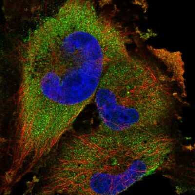 Immunocytochemistry/Immunofluorescence: UBE2K/E2-25K Antibody [NBP1-91987] - Staining of human cell line U-251 MG shows localization to cytosol.