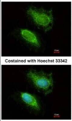 Immunocytochemistry/Immunofluorescence: UBE2K/E2-25K Antibody [NBP2-16831] - Immunofluorescence analysis of methanol-fixed HeLa, using antibody at 1:200 dilution.