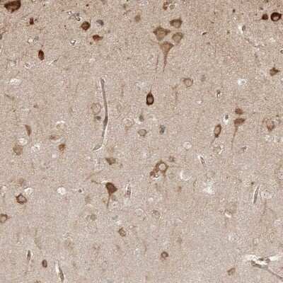 Immunohistochemistry-Paraffin: UBE2K/E2-25K Antibody [NBP1-91987] - Staining of human cerebral cortex shows strong cytoplasmic positivity in neuronal cells.