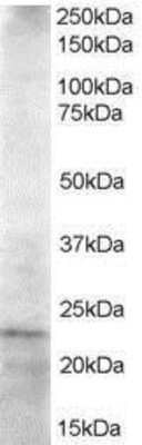 Western Blot UBE2K/E2-25K Antibody