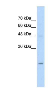 Western Blot: UBE2K/E2-25K Antibody [NBP1-54914] - Jurkat cell lysate, concentration 5.0ug/ml.