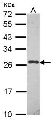 Western Blot: UBE2K/E2-25K Antibody [NBP2-16831] - Sample (30 ug of whole cell lysate) A: HCT116 12% SDS PAGE gel, diluted at 1:1000.