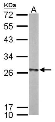 Western Blot UBE2K/E2-25K Antibody