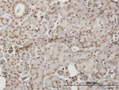 Immunohistochemistry-Paraffin: HIPK1 Antibody (1D6) [H00204851-M06] - Analysis of monoclonal antibody to HIPK1 on formalin-fixed paraffin-embedded human salivary gland. Antibody concentration 3 ug/ml