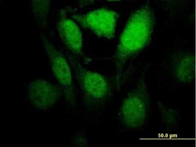 Immunocytochemistry/Immunofluorescence: HIPK1 Antibody (1F2) [H00204851-M04] - Analysis of monoclonal antibody to HIPK1 on HeLa cell. Antibody concentration 35 ug/ml