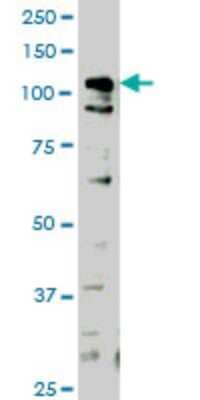 Western Blot: HIPK1 Antibody (1F2) [H00204851-M04] - Analysis of HIPK1 expression in HeLa (Cat # L013V1).