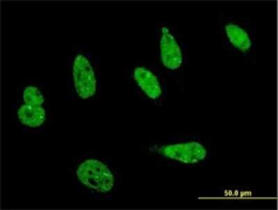 Immunocytochemistry/ Immunofluorescence HIPK1 Antibody (4C2)