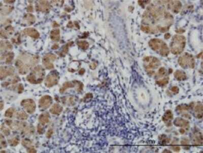 Immunohistochemistry-Paraffin: HIPK1 Antibody (4C2) [H00204851-M01] - Analysis of monoclonal antibody to HIPK1 on formalin-fixed paraffin-embedded human salivary gland. Antibody concentration 3 ug/ml.