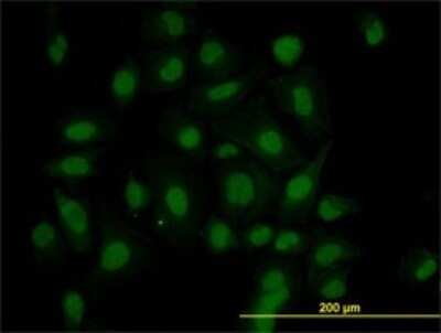 Immunocytochemistry/Immunofluorescence: HIPK1 Antibody (4E1) [H00204851-M07] - Analysis of monoclonal antibody to HIPK1 on HeLa cell. Antibody concentration 10 ug/ml