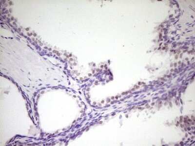 Immunohistochemistry: HIPK1 Antibody (5F1) [NBP2-45973] - Analysis of Human prostate tissue. (Heat-induced epitope retrieval by 1 mM EDTA in 10mM Tris, pH8.5, 120C for 3min)