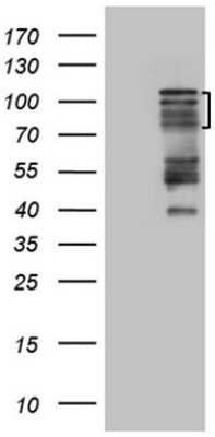 Western Blot HIPK1 Antibody (OTI5F1)