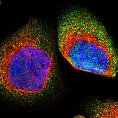 Immunocytochemistry/Immunofluorescence: HIPK1 Antibody [NBP1-82981] - Immunofluorescent staining of human cell line A-431 shows localization to cytosol.