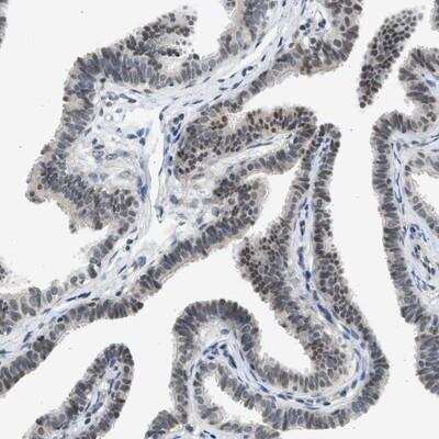 Immunohistochemistry-Paraffin: HIPK1 Antibody [NBP1-82981] - Staining of human fallopian tube shows moderate nuclear positivity in glandular cells.