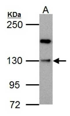 Western Blot: HIPK1 Antibody [NBP2-16833] - Sample (30 ug of whole cell lysate) A: PC-3 5% SDS PAGE gel, diluted at 1:500.