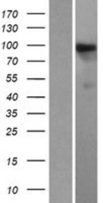 Western Blot HIPK1 Overexpression Lysate