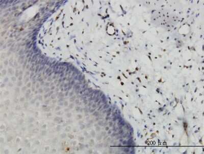 Immunohistochemistry-Paraffin: HIPK2 Antibody (1F10) [H00028996-M03] - Analysis of monoclonal antibody to HIPK2 on formalin-fixed paraffin-embedded human esophagus. Antibody concentration 1 ug/ml