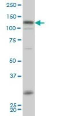 Western Blot: HIPK2 Antibody (1F10) [H00028996-M03] - Analysis of HIPK2 expression in MES-SA/Dx5 (Cat # L021V1).