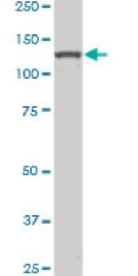 Western Blot: HIPK2 Antibody (1F10) [H00028996-M03] - Analysis of HIPK2 expression in RIN-m5F.