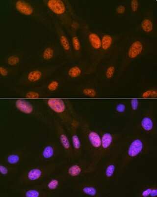 Immunocytochemistry/Immunofluorescence: HIPK2 Antibody (3Z5P6) [NBP3-16825] - Immunofluorescence analysis of U-2 OS cells using HIPK2 Rabbit mAb (NBP3-16825) at dilution of 1:100 (40x lens). Blue: DAPI for nuclear staining.