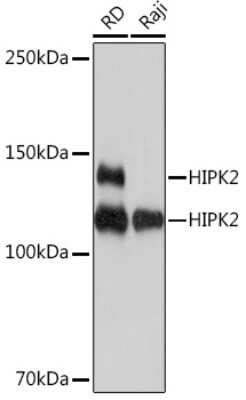 Western Blot: HIPK2 Antibody (3Z5P6) [NBP3-16825] - Western blot analysis of extracts of various cell lines, using HIPK2 Rabbit mAb (NBP3-16825) at 1:1000 dilution. Secondary antibody: HRP Goat Anti-Rabbit IgG (H+L) at 1:10000 dilution. Lysates/proteins: 25ug per lane. Blocking buffer: 3% nonfat dry milk in TBST. Detection: ECL Basic Kit. Exposure time: 1s.