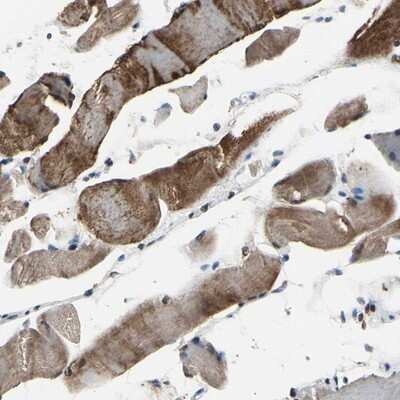 Immunohistochemistry-Paraffin: HIPK2 Antibody [NBP1-89462] - Staining of human skeletal muscle shows strong cytoplasmic positivity in myocytes.