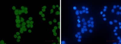 Immunocytochemistry/Immunofluorescence: HIPK2 Antibody (S06-5G2) [NBP3-19873] - Immunocytochemistry of HIPK2 (green) in hela using NBP3-19873 at dilution 1/50, and DAPI (blue)