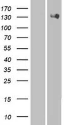 Western Blot: HIPK2 Overexpression Lysate (Adult Normal) [NBP2-06409] Left-Empty vector transfected control cell lysate (HEK293 cell lysate); Right -Over-expression Lysate for HIPK2.