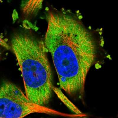 Immunocytochemistry/Immunofluorescence: HIPK3 Antibody [NBP1-84950] - Immunofluorescent staining of human cell line U-251 MG shows localization to cytosol.
