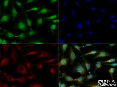 Immunocytochemistry/Immunofluorescence: HIPK3 Antibody [NBP2-24521] - HeLa cells were fixed for 10 minutes using 10% formalin and then permeabilized for 5 minutes using 1X TBS + 0.5% Triton-X100. The cells were incubated with anti-HIPK3 [NBP2-24521] at a 1:200 dilution overnight at 4C and detected with an anti-rabbit Dylight 488 (Green) at a 1:500 dilution. Alpha tubulin (DM1A) NB100-690 was used as a co-stain at a 1:1000 dilution and detected with an anti-mouse Dylight 550 (Red) at a 1:500 dilution. Nuclei were counterstained with DAPI (Blue). Cells were imaged using a 40X objective. 